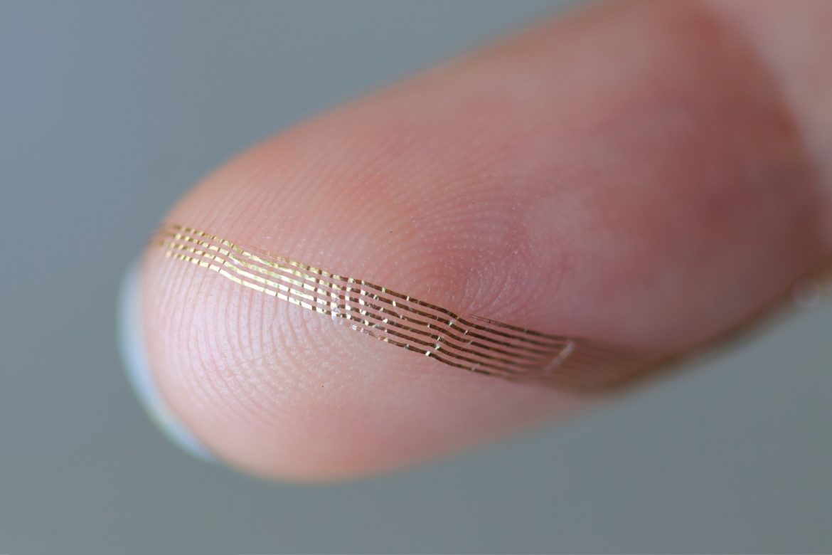 <a href="https://news.harvard.edu/gazette/section/health/">
			Health		</a>
		
		
		Brain implants that don’t leave scars	
	
			
		
Axoft’s flexible brain implant. Axoft Inc.
	
		
			
					
		Kirsten Mabry	
			
			Harvard Office of Technology Development		
					
		
		
			August 14, 2025		
		
			6 min read		
	
	
			
			Harvard startup is developing a softer device to monitor head injuries		
		
Traumatic brain injuries vary in severity from mild to life-threatening, but neurologists have limited tools to assess the damage. While examinations and external imaging can help, neural probes — devices that create brain-computer interfaces — are even better. The problem? They are made of rigid materials that scar the brain.
<a href="https://axoft.us/">Axoft</a>, a startup launched out of Harvard in 2021, is developing a softer alternative, one the company’s researchers say could be inserted into the brain without disturbing its gel-like consistency but is durable enough to deliver accurate neural data.
“With a brain-computer interface, we can determine very precisely what’s happening in the brains of the patients — if they are conscious, if they are not conscious, if they are vegetative, if they are recovering, or if their state is degrading,” said Paul Le Floch, co-founder and CEO of Axoft, who received his Ph.D. in materials science from Harvard.
Clinicians have used neural probes for decades. When inserted into the brain, they measure electrical activity with much more accuracy than external neural imaging. But traditionally, neural probes have been made of rigid materials, which damage the surrounding, highly flexible brain tissue — like razor blades in gel, said Le Floch. Damage to the brain makes neural probes less effective, because the brain responds by surrounding them with scar tissue. Encapsulated in that more rigid tissue, the probes cannot communicate as readily with the neurons around them. Plus, rigid devices can only stay implanted for a short time before they significantly scar the brain. As more sensors are added to a neural probe — an essential element of gathering as much brain activity data as possible — the probes become even more rigid.
<blockquote>Traditionally, neural probes have been made of rigid materials, which damage the surrounding, highly flexible brain tissue — like razor blades in gel.</blockquote>
Le Floch and his collaborators understood that they needed a softer alternative to existing neural probes. “The problem is: Soft materials are not very high-performance,” he said.
During a Ph.D. focused on material science and polymers at Harvard, Le Floch began working as a graduate student in the lab of <a href="https://liulab.seas.harvard.edu/prof-jia-liu">Jia Liu</a>, an assistant professor of bioengineering at the John A. Paulson School of Engineering and Applied Sciences. Le Floch and Liu focused on an intractable problem: engineering neural probes that worked better for the brain.
Le Floch and Liu collaborated with Tianyang Ye, Ph.D. ’20, a graduate student and then postdoctoral scholar at Harvard specializing in nanoelectronics, as well as a fellow at the <a href="https://otd.harvard.edu/">Office of Technology Development</a> (OTD), where he worked on commercialization strategies for academic innovations. Ye is now Axoft’s chief technology officer, as well as a co-founder. While Le Floch engineered a higher-performance, soft material that could be inserted into the brain without harming it, Ye designed the electronics that could transmit the data for analysis.
The resulting neural probe is “very biocompatible, because it’s so small, but also very soft,” said Le Floch. “It creates less damage within tissues over time.”
Paul Le Floch (left) and Jia Liu.
Axoft’s novel material, Fleuron, is thousands to millions of times softer and more flexible than the material used in modern neural probes. At the same time, Fleuron is a photoresist, applicable for the chip-fabrication process. As a result, the probe can easily fit more than 1,000 sensors, delivering precise brain-signal data to clinicians. 
“In the last few decades, we’ve gone from measuring one neuron, to 10 neurons, to hundreds of neurons — now we’re getting into thousands,” said Le Floch. Those greater multitudes allow researchers to “learn more about the brain and develop new diagnoses and therapies.”
Axoft is working to double the number of electrodes its probe can host every year as it continues to develop the technology. “This will significantly increase the number of neurons Axoft’s probes can measure and stimulate,” said Liu, who helped co-found the company and joined as a scientific adviser.
Brain implants are not necessary for every patient with neurological damage, Le Floch says, but the company has already experienced significant interest from neurologists who have struggled to measure the brain activity of unresponsive patients with acute and traumatic brain injuries.
<blockquote>“We see a big need from a patient perspective.”<cite>Paul Le Floch, Axoft CEO</cite></blockquote>
The impact of the startup’s work was clear from the beginning, according to Christopher Petty, OTD director of business development in physical sciences. “From our point of view, we’re always talking about this mission of taking academically generated knowledge and making a difference in the world with it. This is that in spades,” he said. “That’s the point of everything we’re doing.”
OTD safeguarded the intellectual property of the core discoveries, connected Axoft’s team with potential investors and structured the startup’s license to further develop the technology, while helping its founding researchers think about real-world applications and the journey from testing to commercialization.
Helping a medical device startup flourish, says Petty, differs from the process for a software startup. The clinical trials necessary for approval can take a significant amount of time and cost a lot of money, but there’s also a much more clearly defined path to market. “There’s a clear set of milestones,” Petty said.
Since its founding, Axoft has been working to hurdle those milestones. The company has raised more than $18 million in funding thus far. In 2025, it completed its first human trial at the Panama Clinic in Panama, which demonstrated that the implants were safe to insert and remove and didn’t create additional risks for the brain in the process. The team also determined that the probe could differentiate when patients are conscious or unconscious (due to anesthesia), the latter of which mimics a coma-like state. Within a few minutes, the team was able to measure brain states in the way a functional MRI might over several hours.
Now, in order to generate more preclinical data, Axoft is working with clinicians at Massachusetts General Hospital on porcine models of traumatic brain injury. Le Floch expects Axoft will be able to begin another in-human study with the hospital in the next year.
In 2027, Axoft is targeting an FDA-managed clinical trial focused on individuals with traumatic brain injuries, in whom the device can measure recovery and consciousness. If all goes well, the devices could be available to physicians by 2028. Le Floch believes the implants could quickly scale to hundreds of patients.
“We see a big need from a patient perspective, and there is already an ecosystem in hospitals for using neuromonitoring devices,” he said.
This research received federal funding from the National Science Foundation.